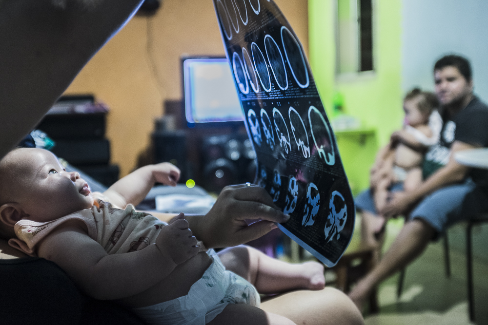 Susanna with her husband  looking at Willian's tomography.