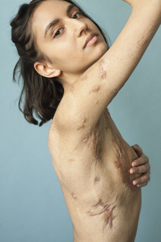 Sophie-Mayanne_Isabella-Behind-The-Scars-1